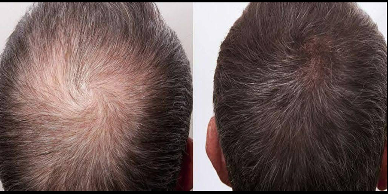 Risultati dopo 30 giorni il nostro amico Marco